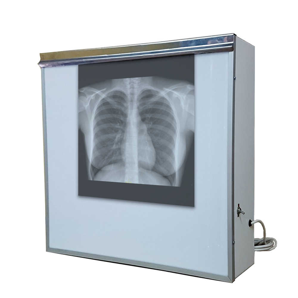 NEGATOSCOPIO SENCILLO